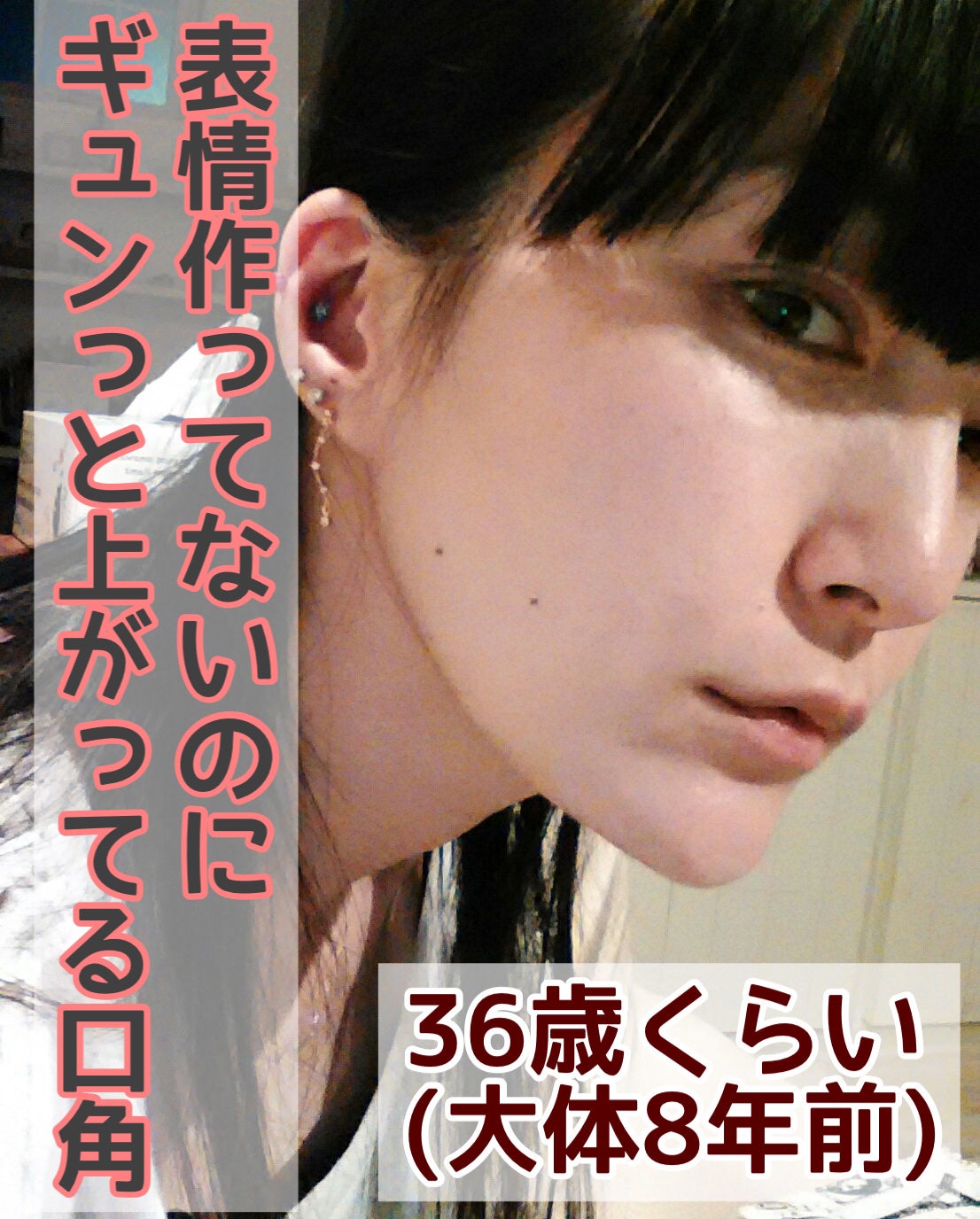 ããðŠçŸå®¹æçš¿ããæ¹ãã©ãã on LIPS ãä»ã®æµè¡ã®é¡ãšããã°ãäžé¡é¢ãçºéããŠçãã倧ããªåºç®ã«æ¶è¢ã..ãïŒ3æç®ïŒ