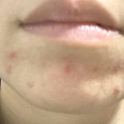 インテンシブ エキナセアクリーム/ARGITAL/フェイスクリームを使ったクチコミ(2枚目)