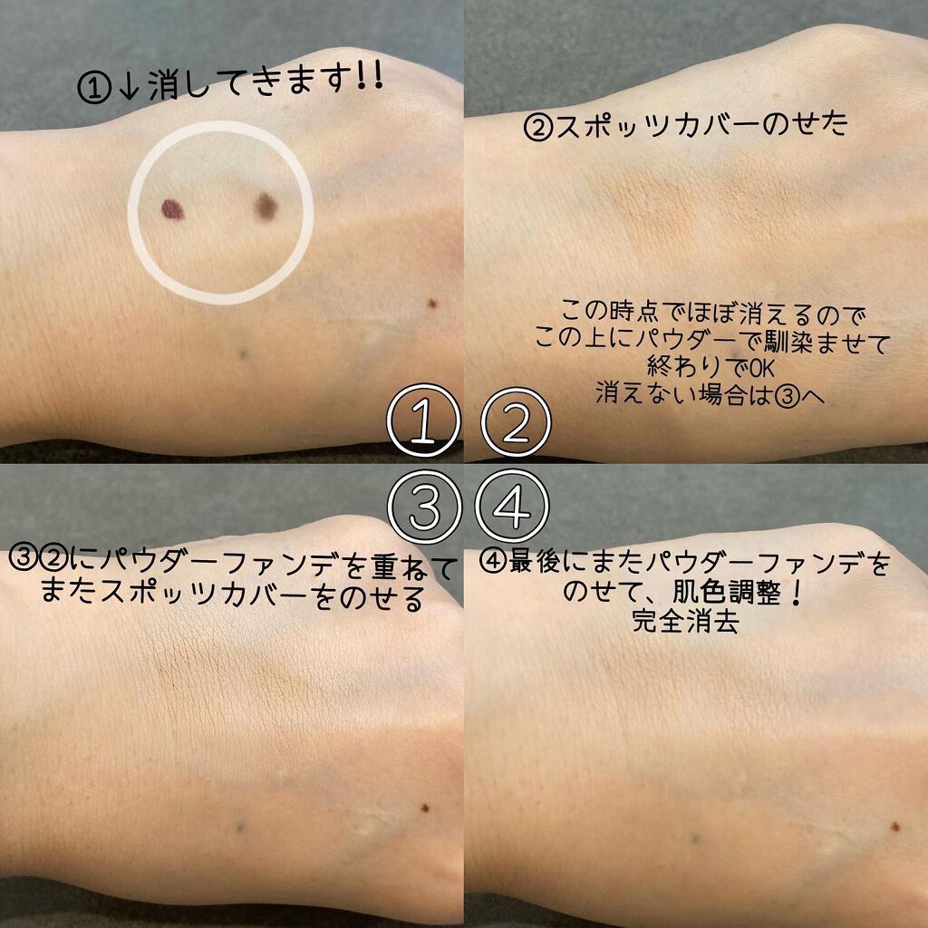 スポッツカバー ファウンデイション/SHISEIDO/クリームコンシーラーを使ったクチコミ(3枚目)