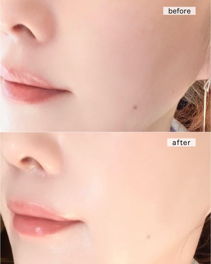 シカバイオプラセンタクリーム/NATURAL DERMA PROJECT/フェイスクリームを使ったクチコミ(5枚目)