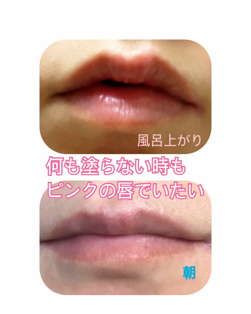 38°C / 99°F リップトリートメント (リップ美容液)/UZU BY FLOWFUSHI/リップケアを使ったクチコミ（2枚目）