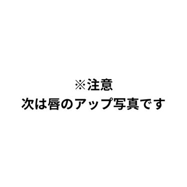 38°C / 99°F リップトリートメント (リップ美容液)/UZU BY FLOWFUSHI/リップケア・リップクリームを使ったクチコミ（2枚目）