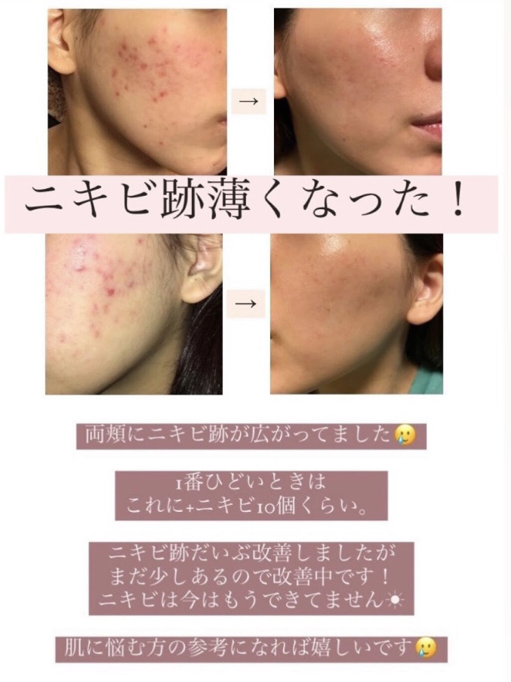 エビアン/伊藤園/ミネラルウォーターを使ったクチコミ（1枚目）