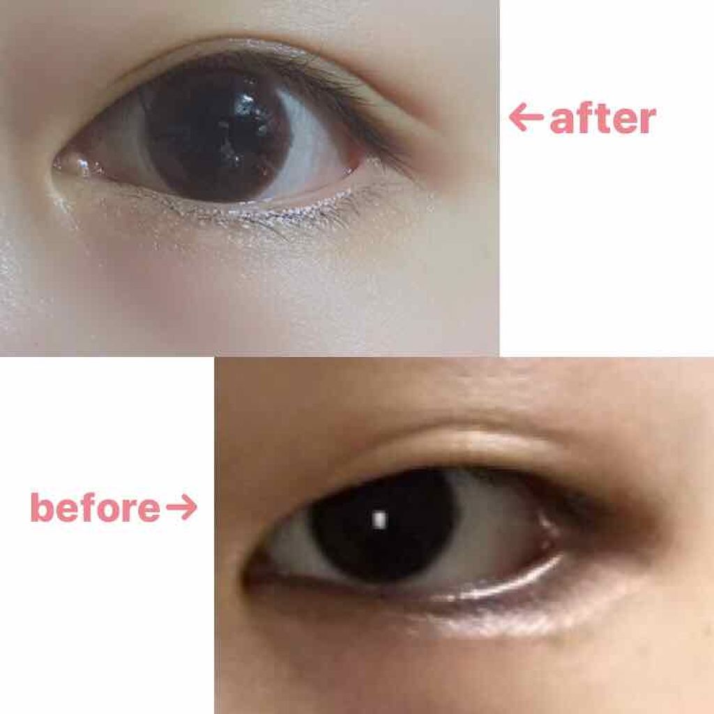 アイテープ片面(のびる)絆創膏タイプ スリム 120枚/セリア/二重まぶた用アイテムを使ったクチコミ（1枚目）