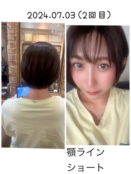 æ¡éŠð·LIPSããŒãããŒâ€ïžâð¥ on LIPS ãçŸå®¹èšé²ââªÂ·Í·âê³â€ïžâð¥hairäºæ
1幎4ã¶ææ¯ãã®çŸå®¹..ãïŒ6æç®ïŒ