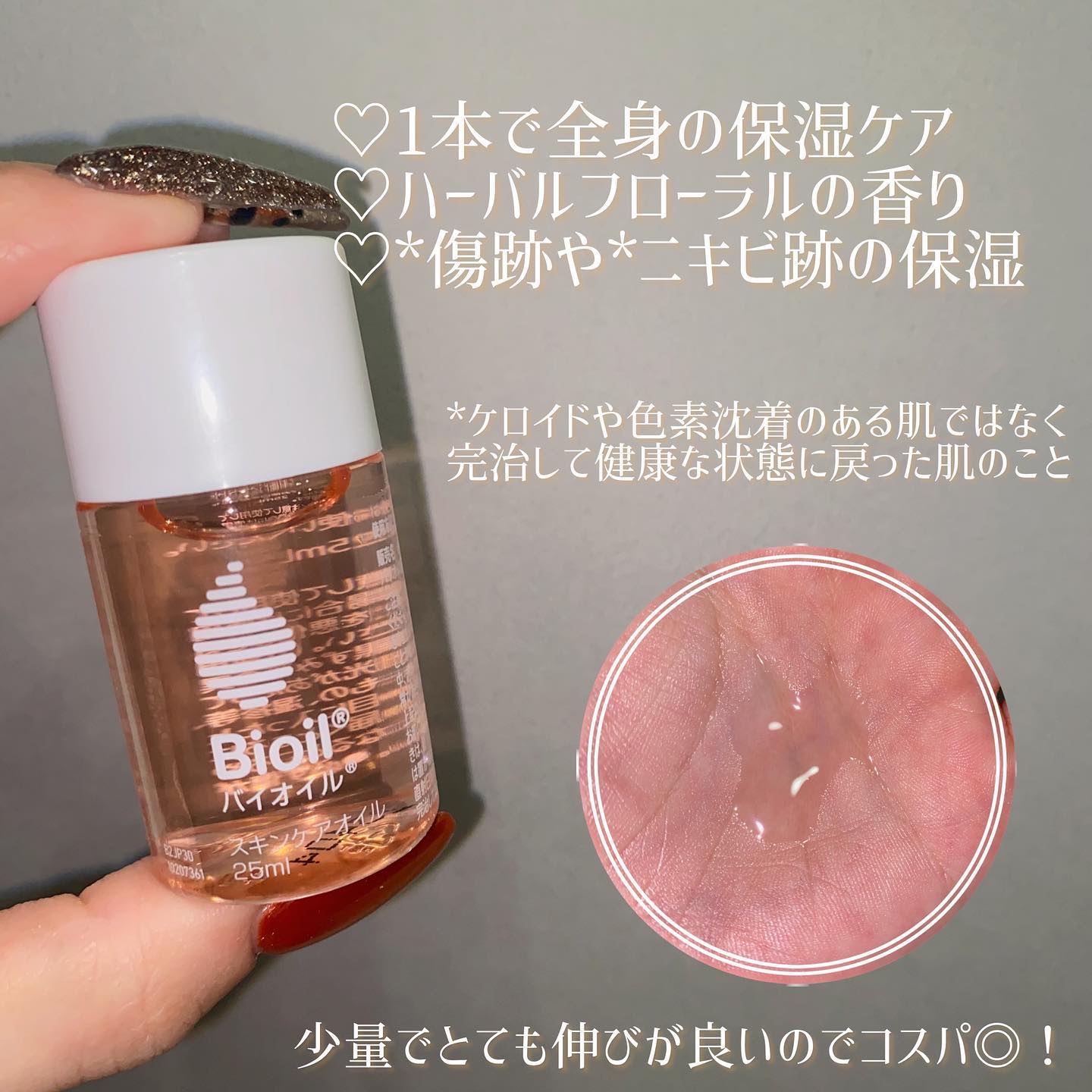 バイオイル/バイオイル/フェイスオイルを使ったクチコミ（2枚目）