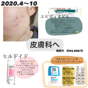 白潤 薬用美白化粧水(しっとりタイプ)/肌ラボ/化粧水を使ったクチコミ（2枚目）