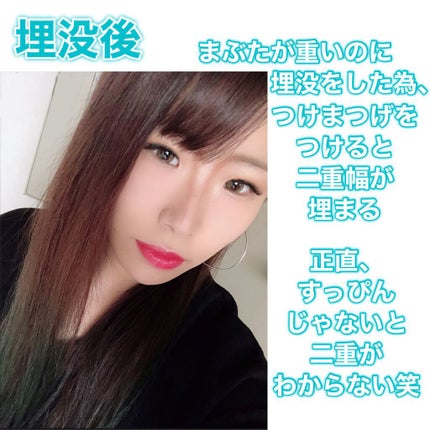 アイトーク/アイトーク/二重まぶた用アイテムを使ったクチコミ(2枚目)