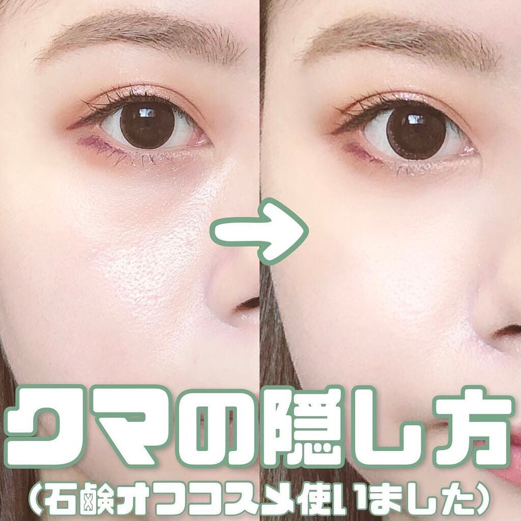 目の下のくまを何とかしたい!【原因別の改善方法やきれいにカバーできる優秀アイテムも】のサムネイル
