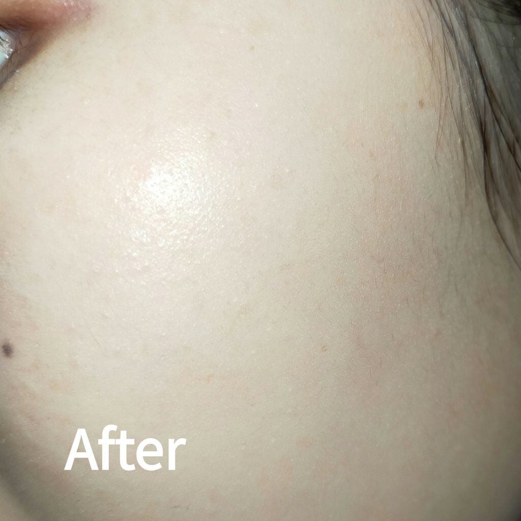 【旧】ディオールスキン フォーエヴァー スキン コレクト コンシーラー/Dior/リキッドコンシーラーを使ったクチコミ(3枚目)
