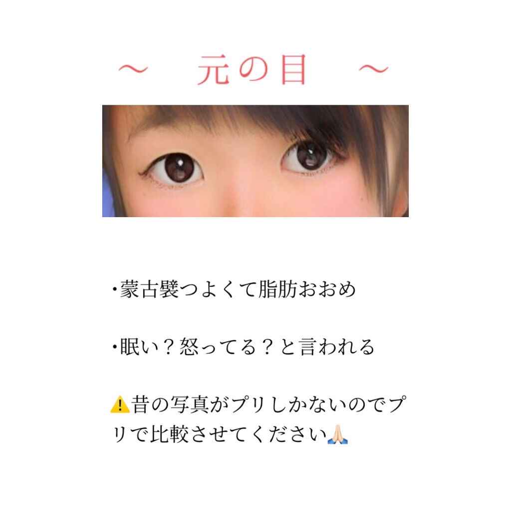 ナイトアイボーテ/StreeTrend/二重まぶた用アイテムを使ったクチコミ(2枚目)