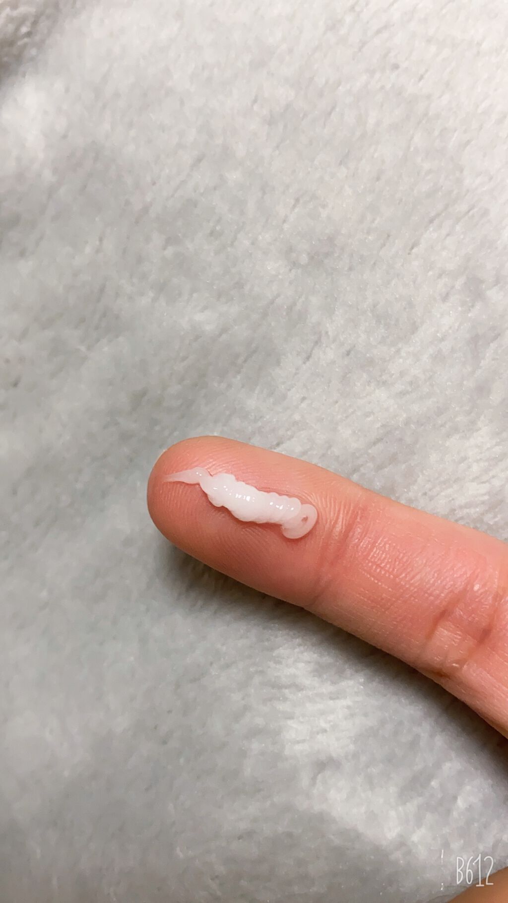 モアリップ N (医薬品)/資生堂薬品/その他を使ったクチコミ（2枚目）