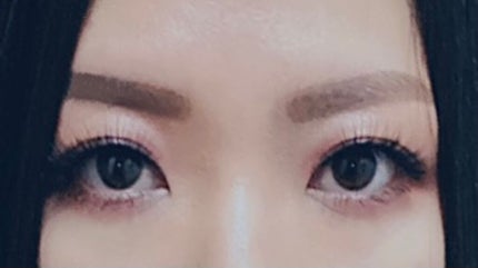 ハイブリッドフィルム/アイトーク/二重まぶた用アイテムを使ったクチコミ(7枚目)