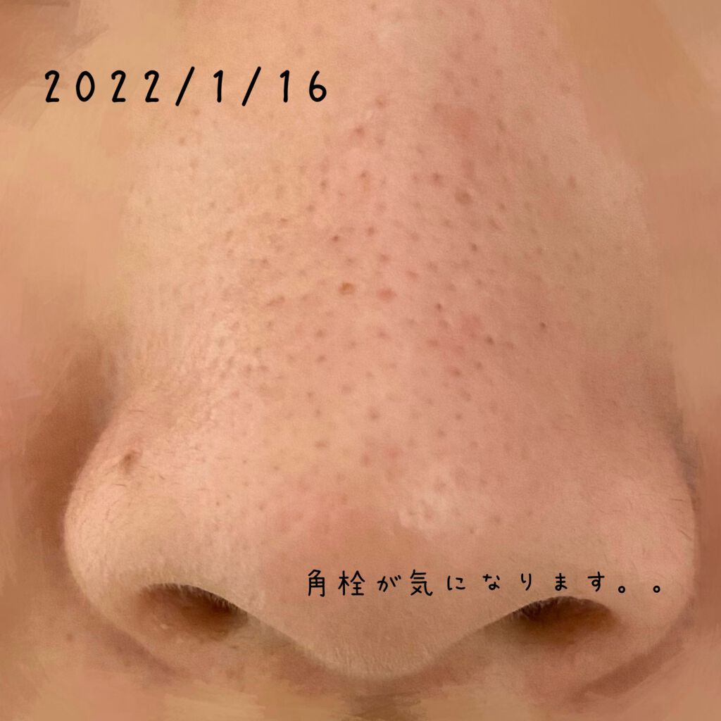 モイスチュア リポソーム/DECORTÉ/美容液を使ったクチコミ(5枚目)