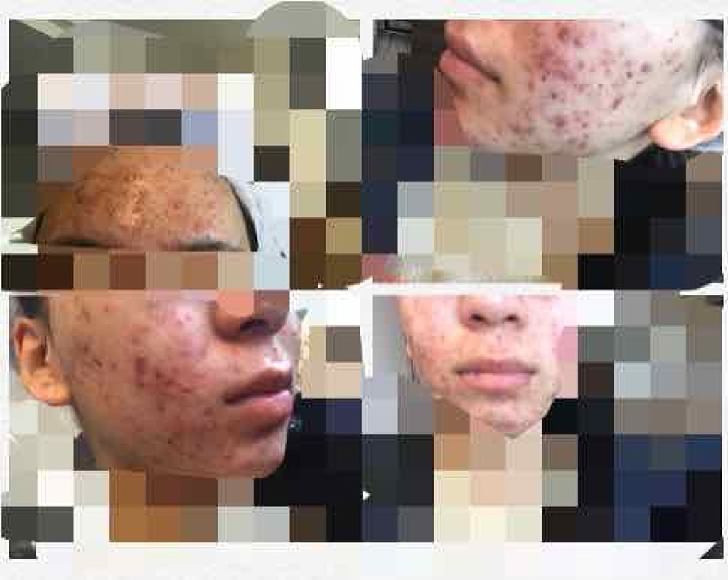 薬用しみ対策 美白化粧水/メラノCC/化粧水を使ったクチコミ（2枚目）