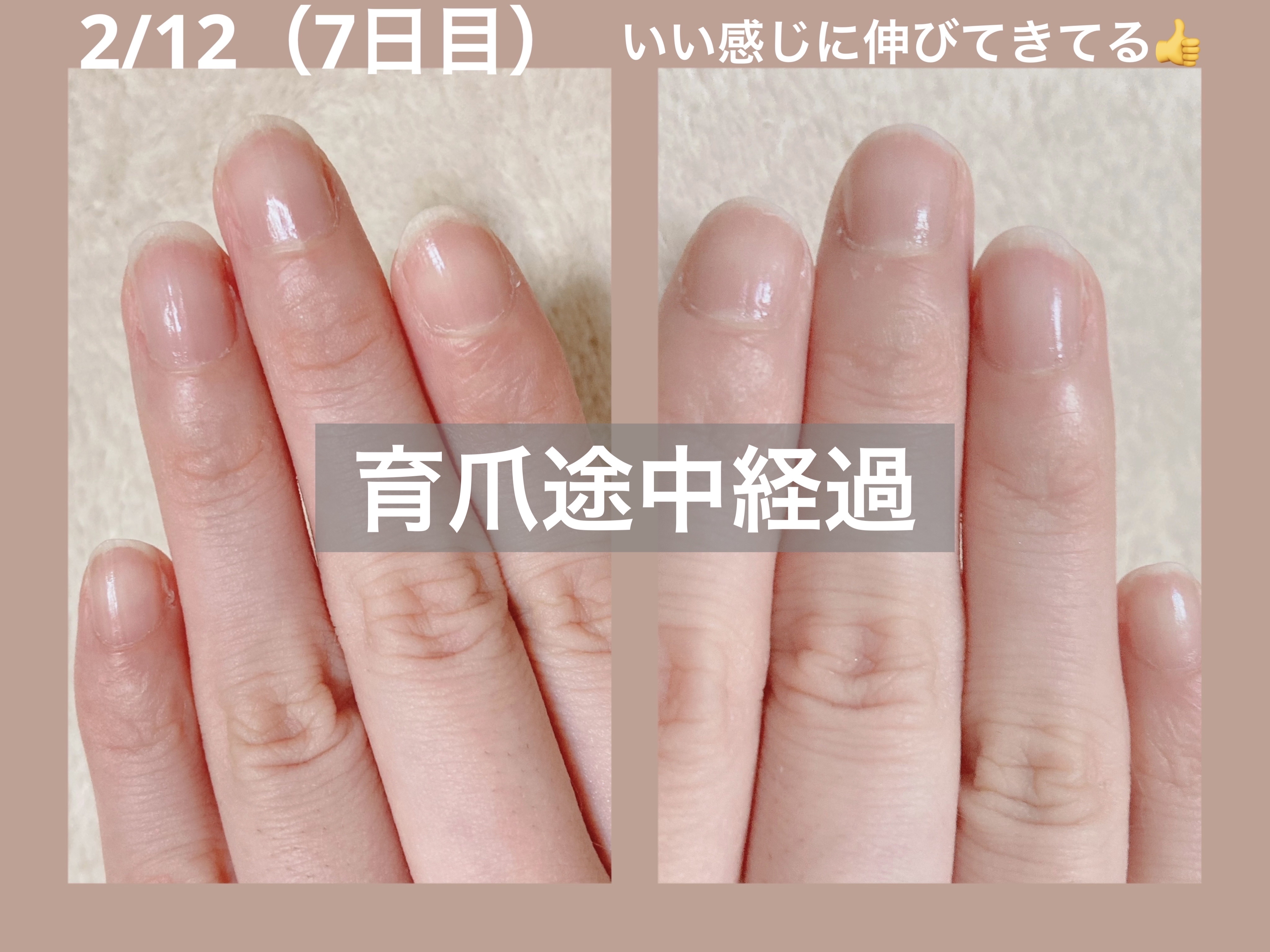 CCネイルコート/ネイルネイル/ネイルオイル・トリートメントを使ったクチコミ（1枚目）