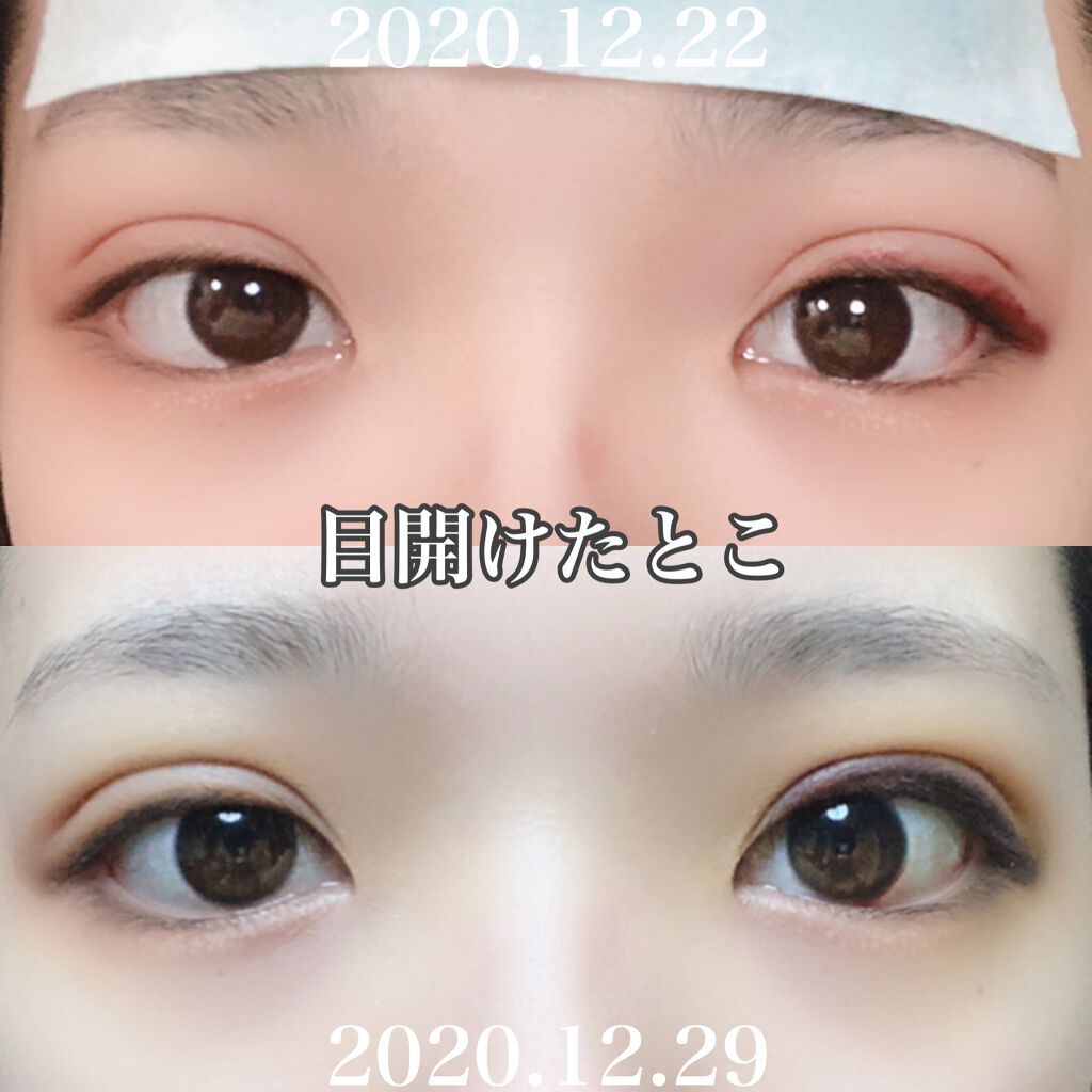 ð¥ã¯ããïŒð¯ on LIPS ãïŒŒåæ²¡1é±éçµéïŒããã«ã¡ã¯ïŒã¯ããã§ãð¯ä»åã¯ïŒãããã®åæ..ãïŒ3æç®ïŒ