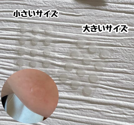 ビューティー スポットパッチ/イージーダムビューティー/にきびパッチを使ったクチコミ(3枚目)