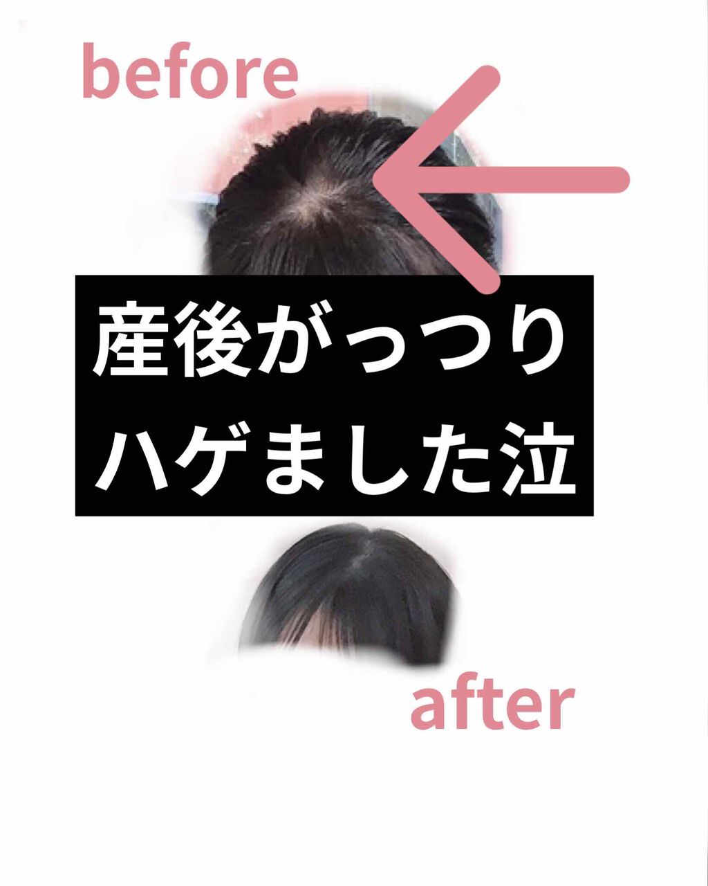 毛根栄養津液エッセンス /呂/頭皮ローションを使ったクチコミ（1枚目）