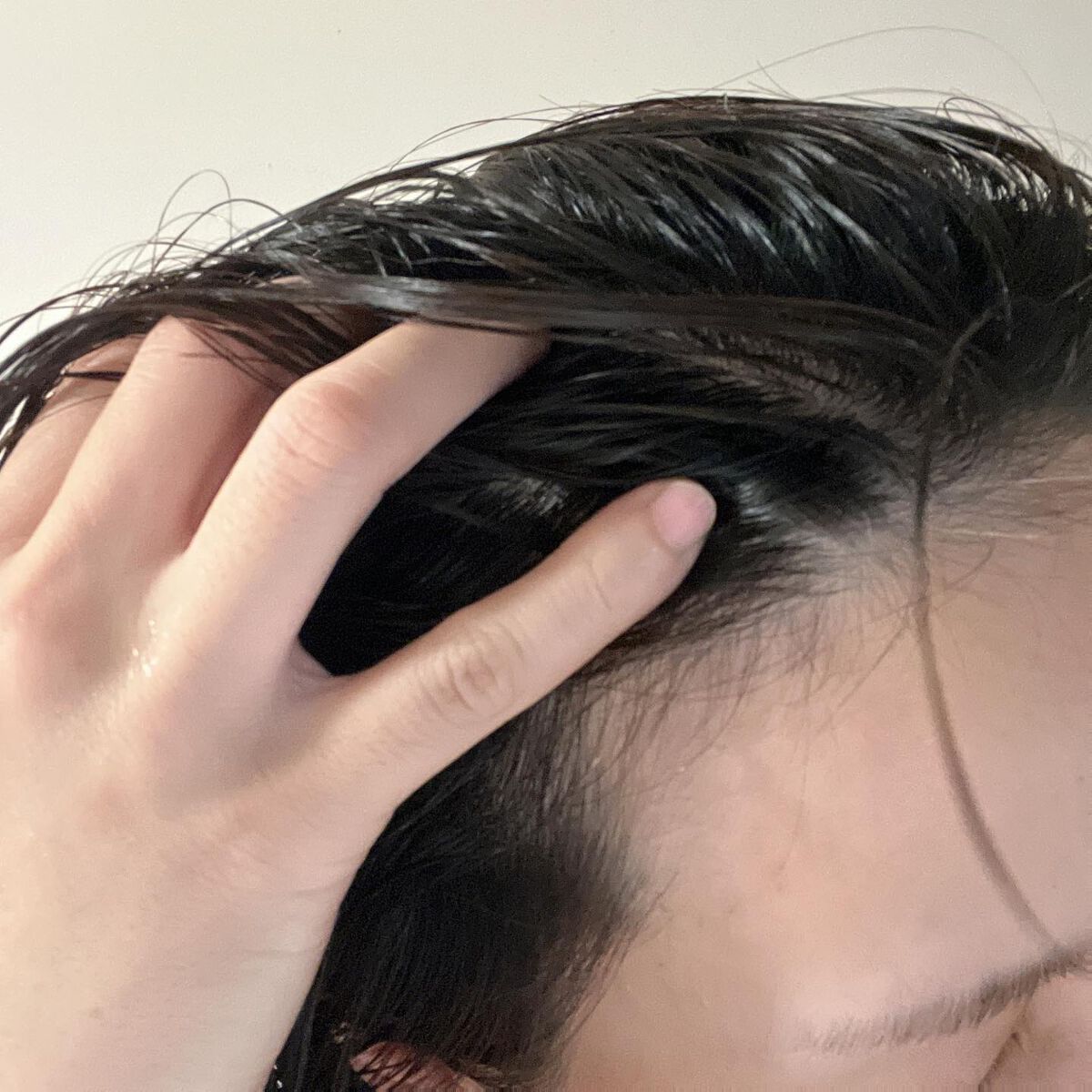 メディケイテッドスカルプフォーム/GROW LAB/頭皮ローションを使ったクチコミ（3枚目）