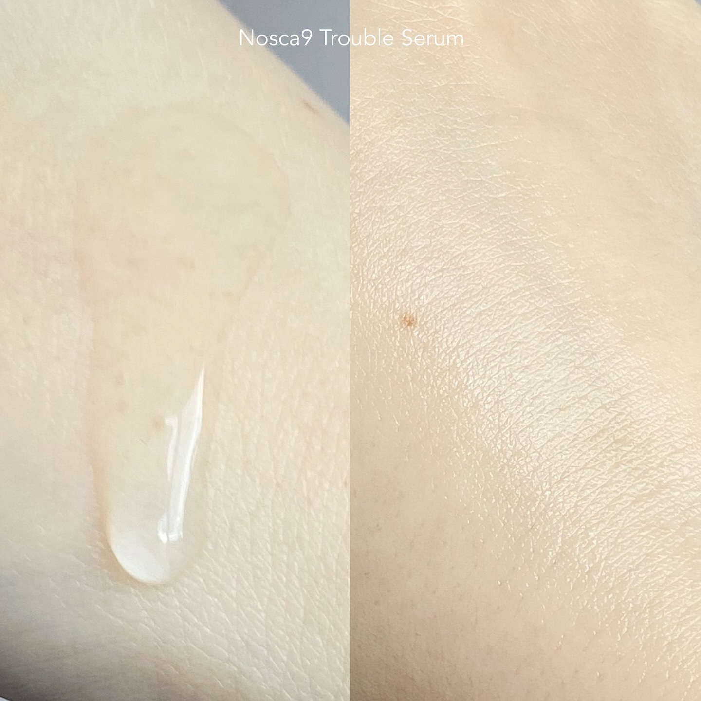 ノスカナイン トラブル セラム/FATION/美容液を使ったクチコミ（3枚目）