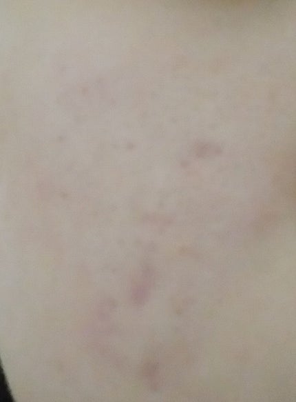 を使ったクチコミ(1枚目)