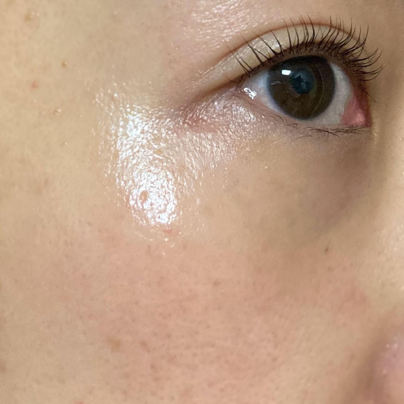 エイシカ365マイクロセラム/AESTURA/美容液を使ったクチコミ（3枚目）