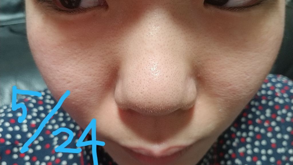 無印良品 クリアケアクリームのクチコミ「24日からこちら使い始めました！
敏感肌用にするか
めっちゃ迷ったんですが…
クリアケアシリー.....」（3枚目）