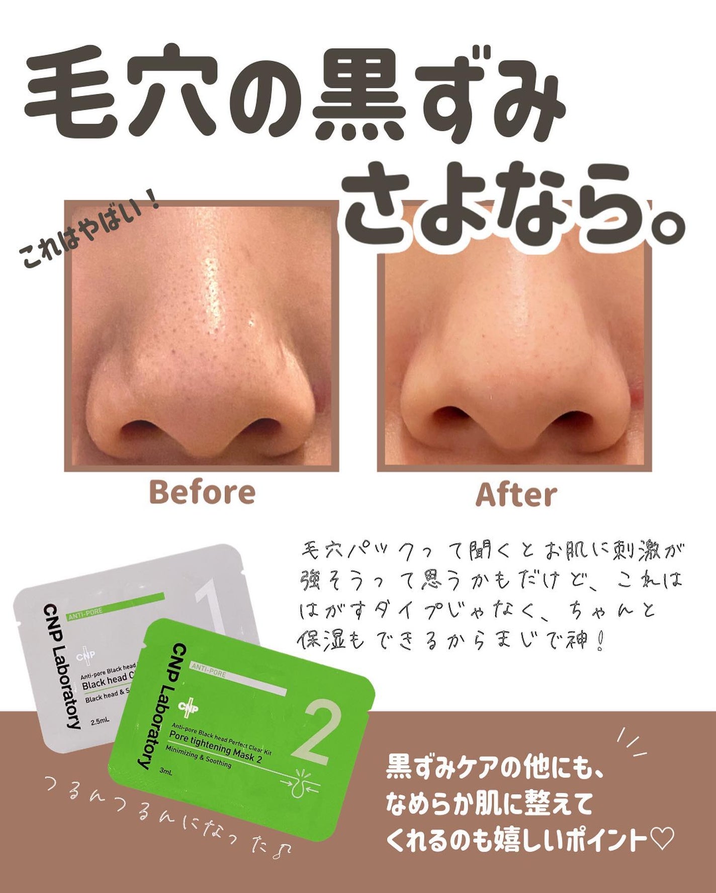 らな ♡ 韓国スキンケア / 韓国コスメ on LIPS 「いちご鼻にさよなら👃✨本日も投稿をみてくださり本当にありがと..」(4枚目)