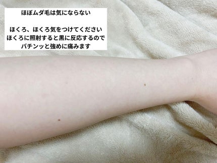 光脱毛器 VIO/Sarlisi/家庭用脱毛器を使ったクチコミ(3枚目)