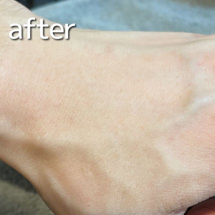 NONON/NONON(ノンノン)/除毛クリームを使ったクチコミ(7枚目)