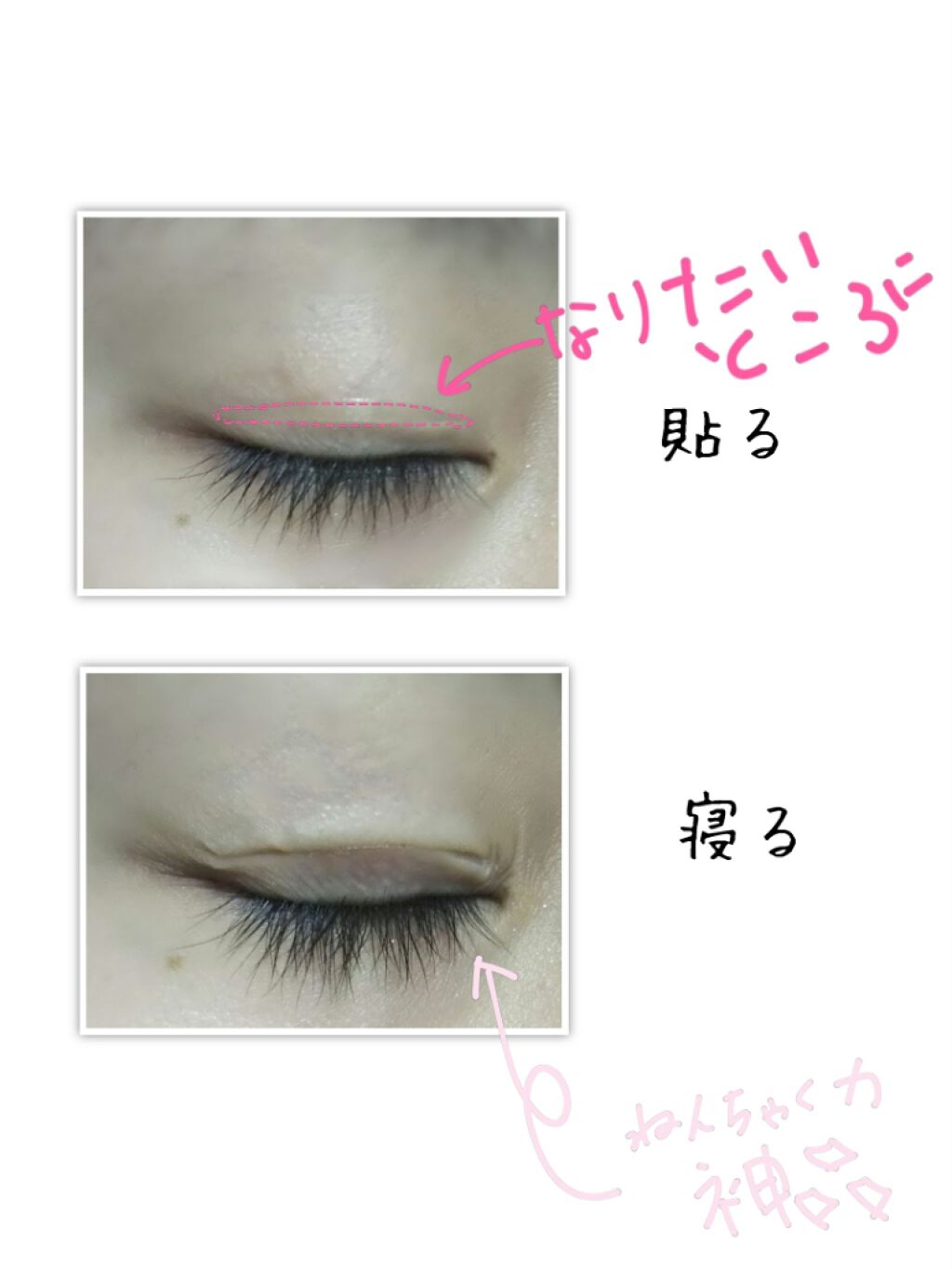 両面二重テープ/DAISO/二重まぶた用アイテムを使ったクチコミ（2枚目）