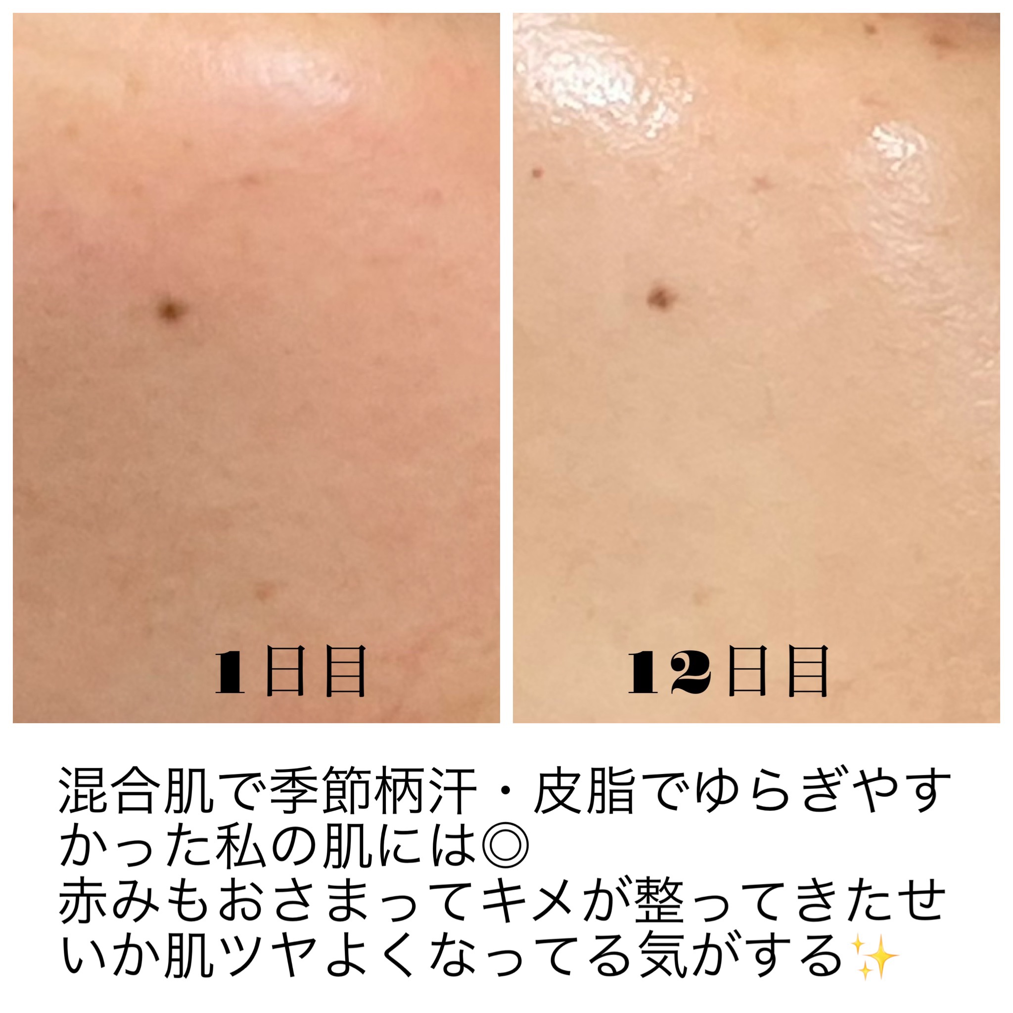 RXザ・ナイアシンアミド15セラム  /COSRX/美容液を使ったクチコミ（3枚目）