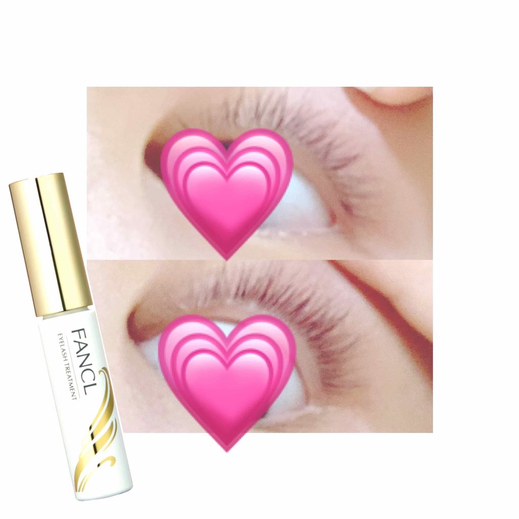 アイラッシュトリートメント/ファンケル/まつげ美容液を使ったクチコミ(1枚目)