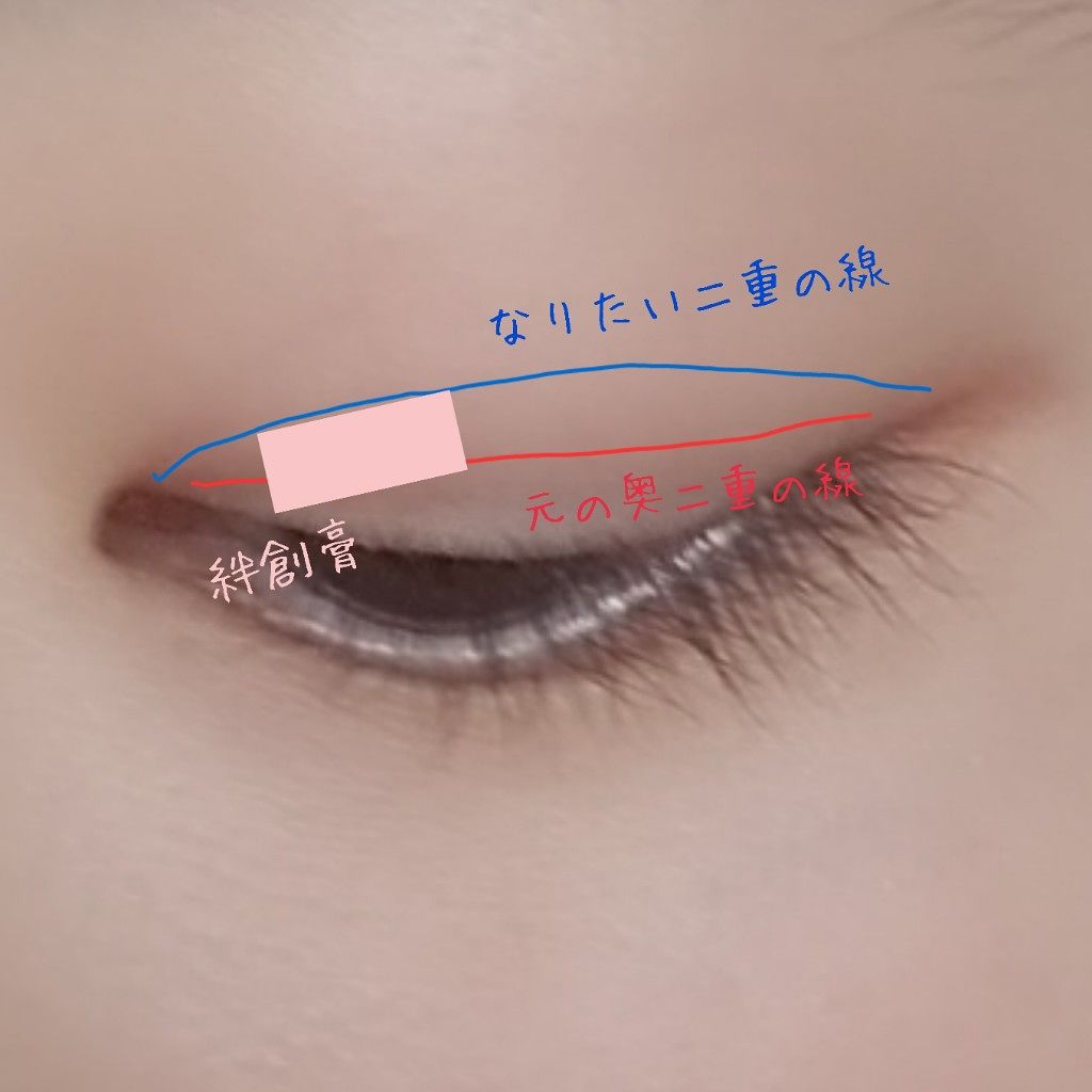 救急ばんそうこう/ドン・キホーテ/その他を使ったクチコミ（3枚目）