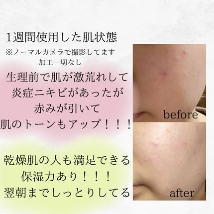 マジックシカクリーム/ブラン/フェイスクリームを使ったクチコミ(4枚目)