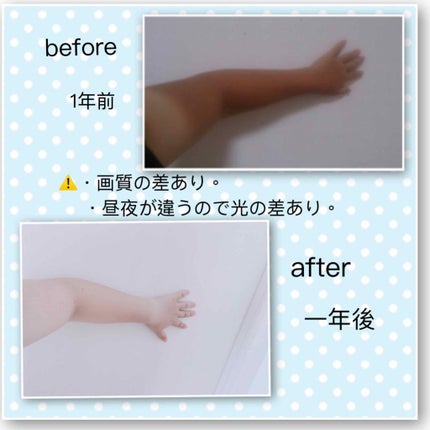 ハトムギ化粧水(ナチュリエ スキンコンディショナー R )/ナチュリエ/化粧水を使ったクチコミ(4枚目)