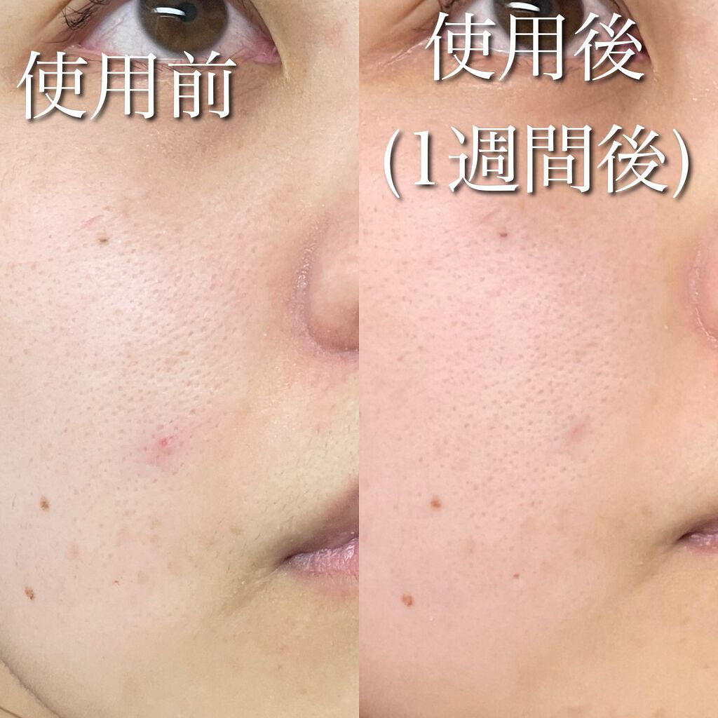 エイジングケア薬用リンクルケアクリームマスク/無印良品/フェイスクリームを使ったクチコミ(4枚目)