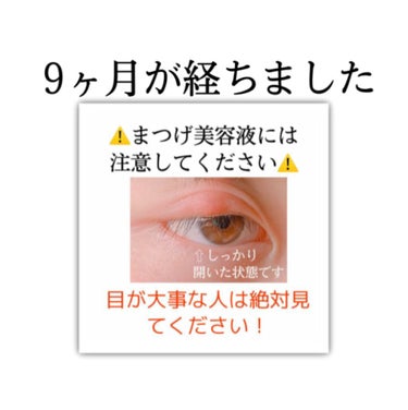 軽い気持ちで使ったまつ毛美容液…。
あの事件からはや9ヶ月…。


なんて格好つけてごめんなさい！笑笑

でももう9ヶ月も経ったんですね🧐🧐

経過をあげるのが遅くなってしまい申し訳ございません🙇‍♀️