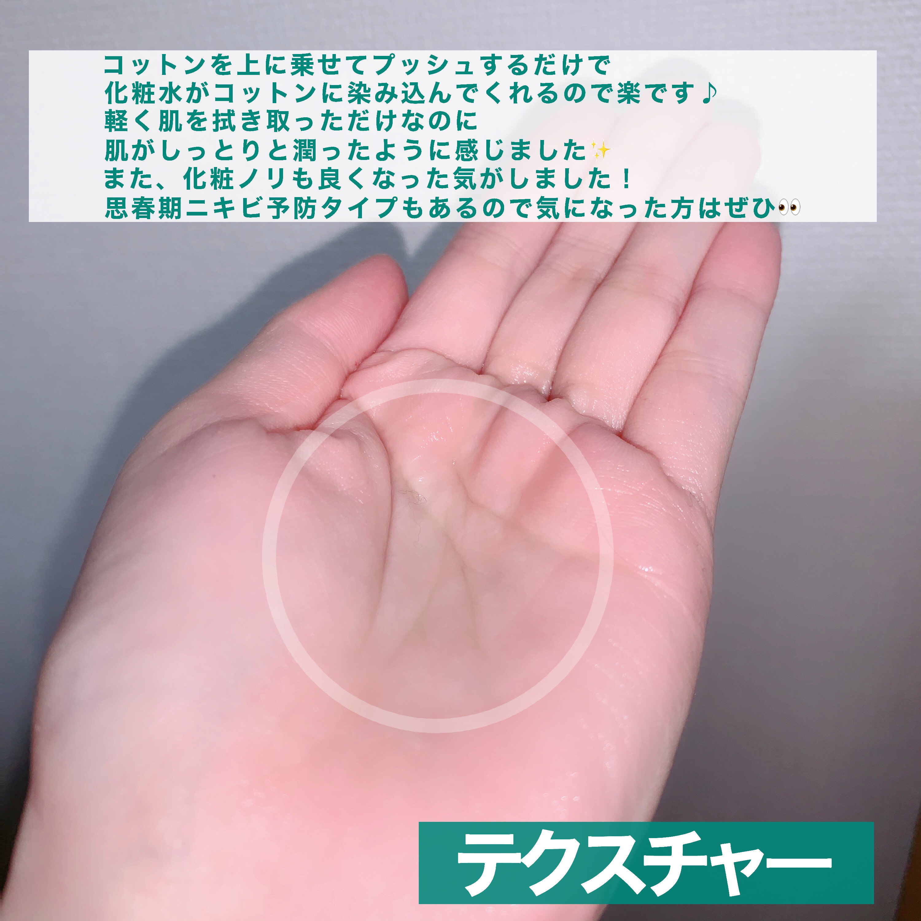 アキュネ 薬用ふきとりローションU/アキュネ/拭き取り化粧水を使ったクチコミ（3枚目）