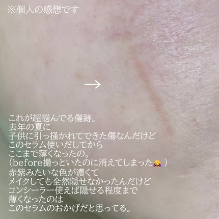 PDRN ピンク ヒアルロニック 水分クリーム/MEDICUBE/フェイスクリームを使ったクチコミ(3枚目)