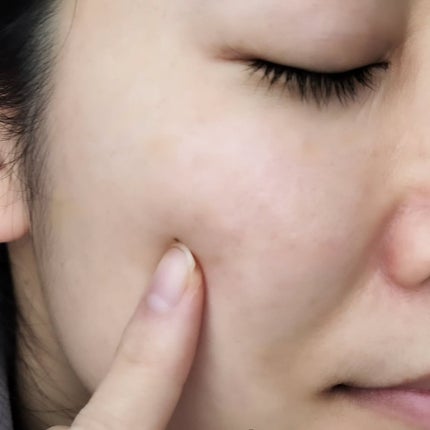 ミストクリーム/MD(エムディ)/フェイスクリームを使ったクチコミ(6枚目)