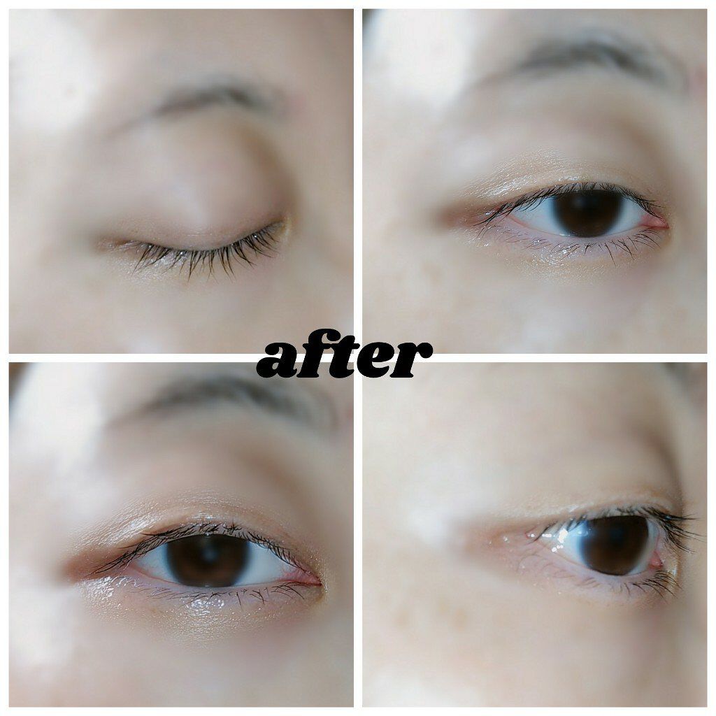 湘南美容まつ毛美容液/Co-medical+/まつげ美容液を使ったクチコミ(5枚目)