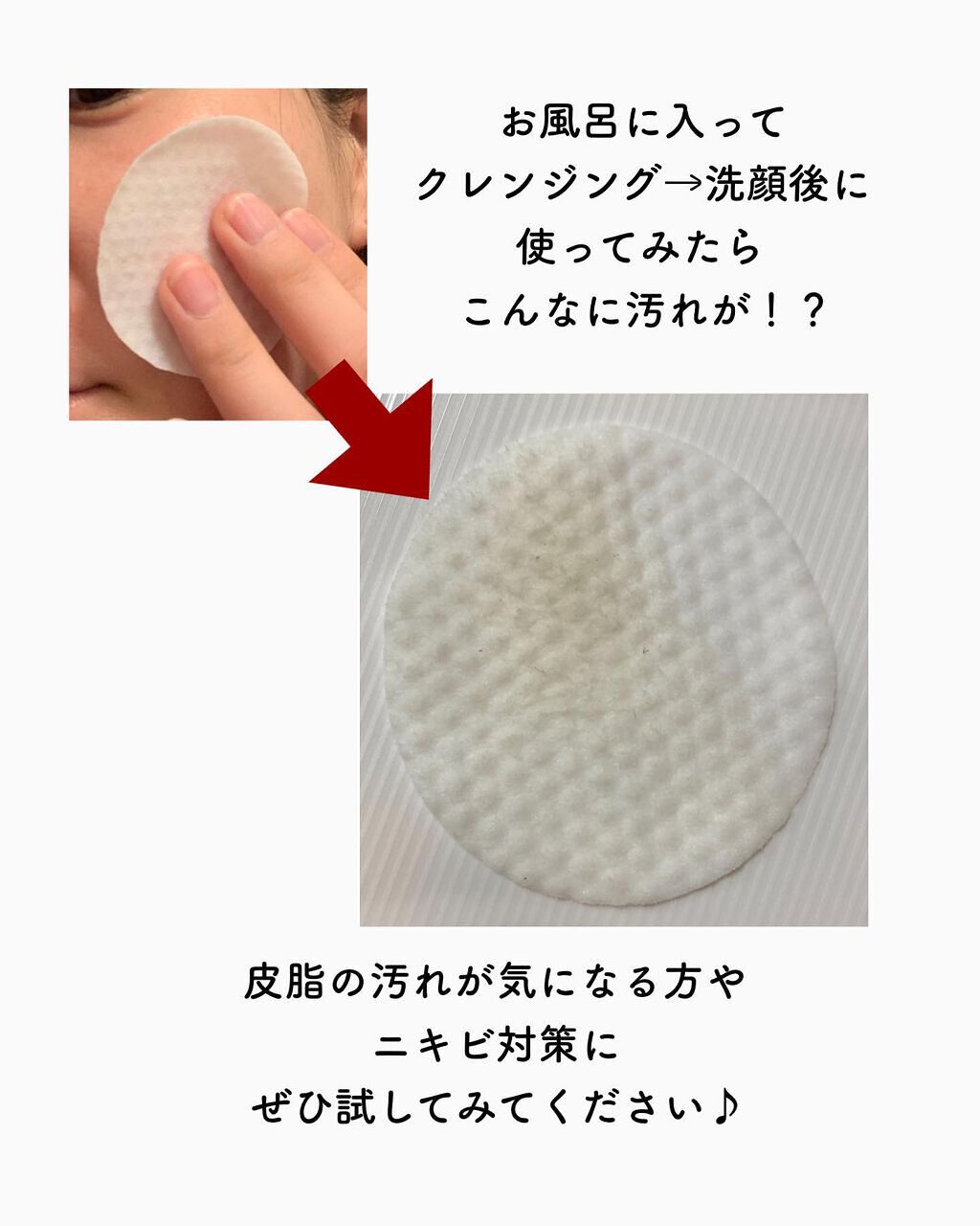 ワンステップオリジナルクリアパッド/COSRX/トナーパッドを使ったクチコミ(6枚目)