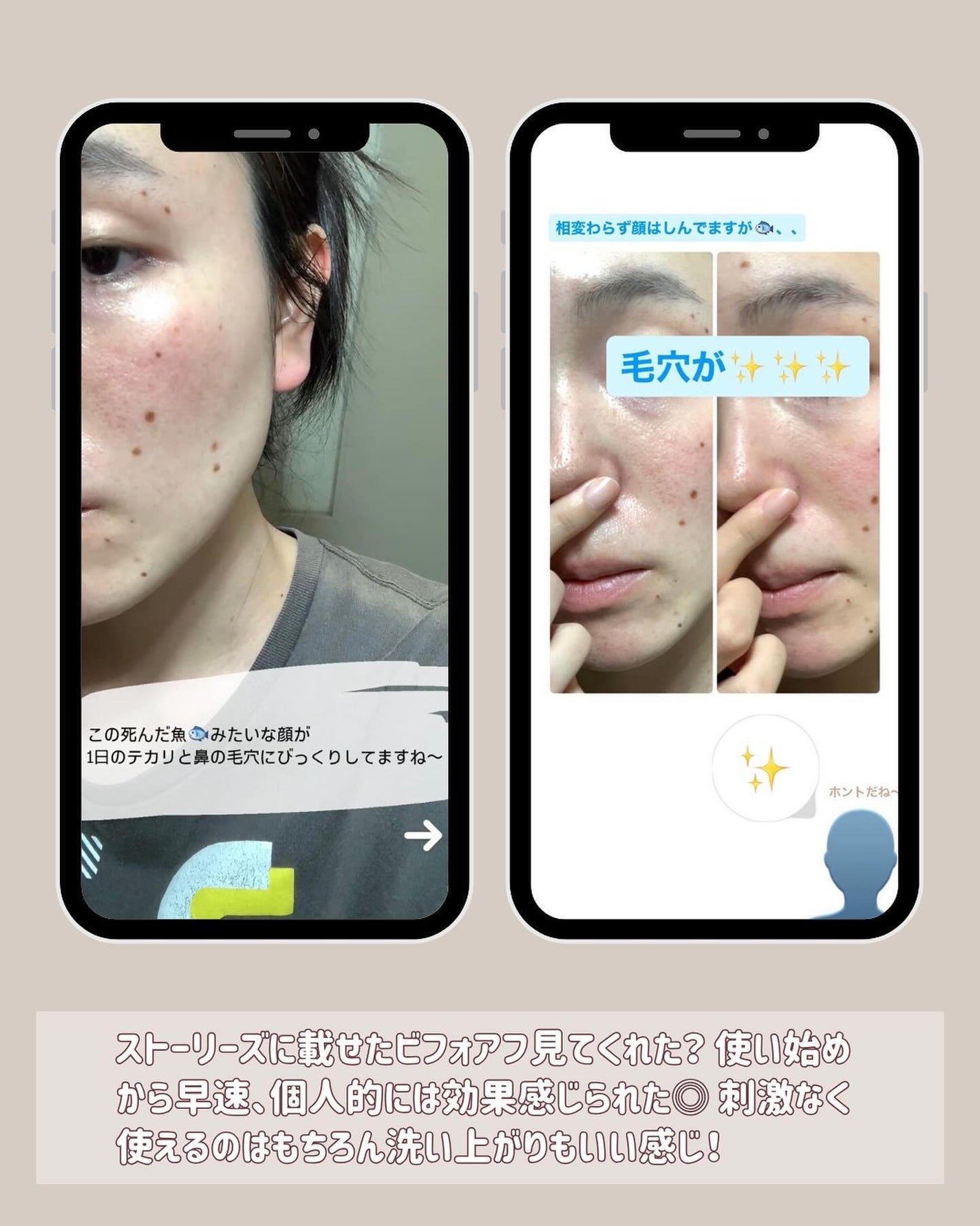 こっすん on LIPS 「PR.めちゃめちゃ大きいサイズだと値段関係なくドンッと遠慮な..」(3枚目)