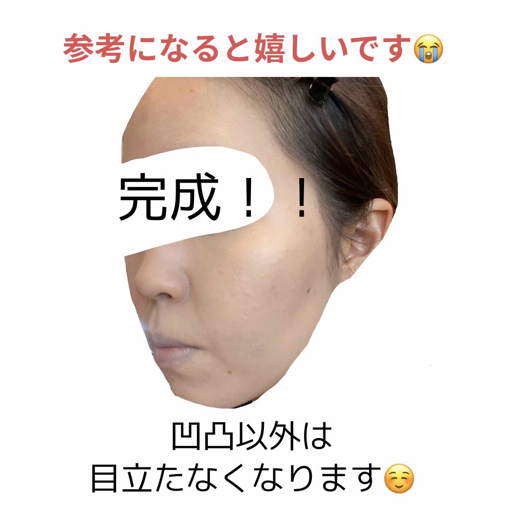 フェイスパウダー 薬用オークル/クリアラスト/プレストパウダーを使ったクチコミ(4枚目)