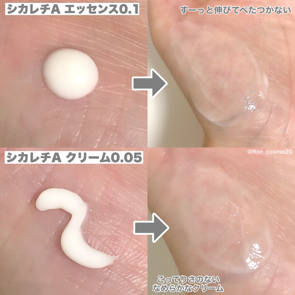 シカレチA エッセンス0.1/VT/美容液を使ったクチコミ（3枚目）