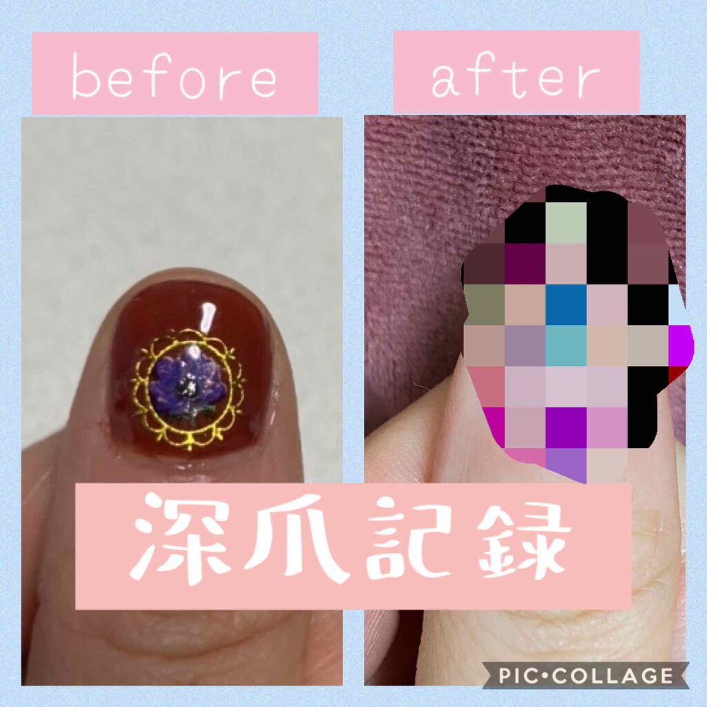 ノンワイプクリア　キャンジェル(トップコート)/プリジェル/ジェルネイルを使ったクチコミ（1枚目）