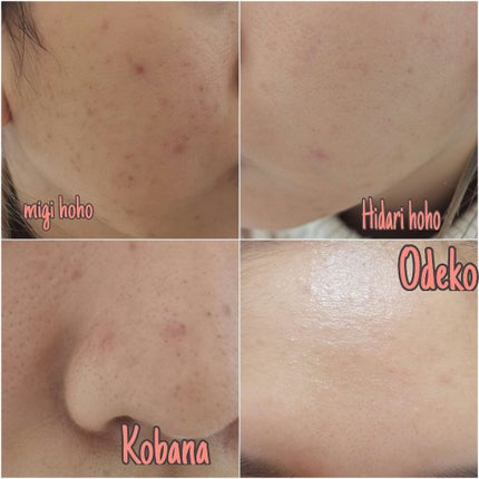 クレンジングジェル/オルビス/クレンジングジェルを使ったクチコミ(1枚目)