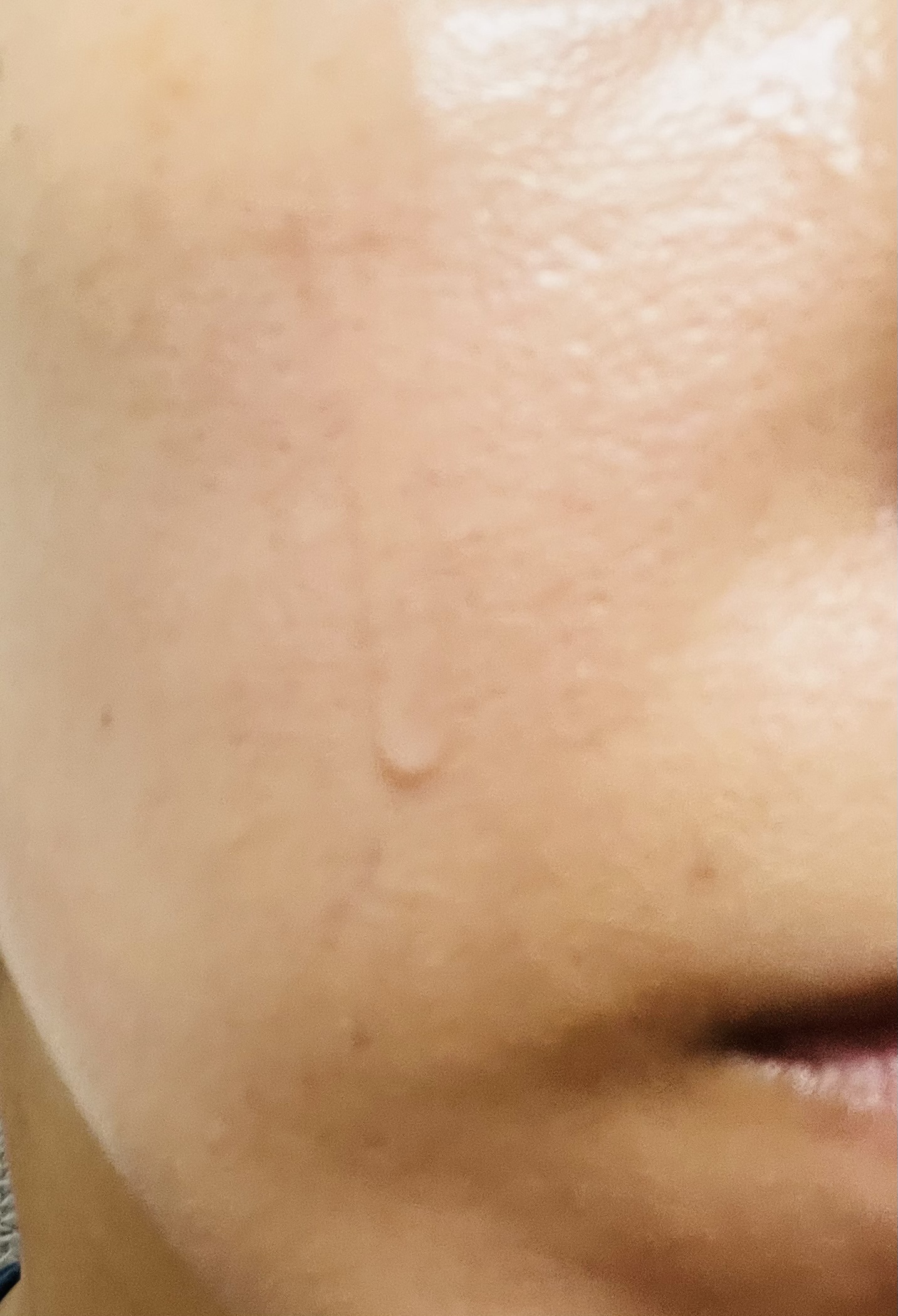 センテラ アンプル/SKIN1004/美容液を使ったクチコミ（3枚目）